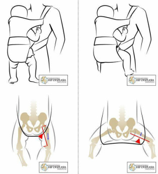 portage physiologique babybjorn