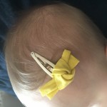 Barrette nœud jaune Tape à l'Oeil